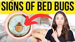 Signs You Have Bed Bugs And How To Get Rid Of Them