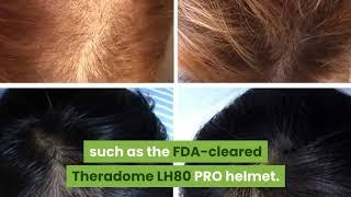 How much does laser hair regrowth treatment helmet cost?