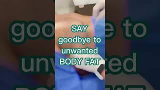 Fat Loss with SmartLipo