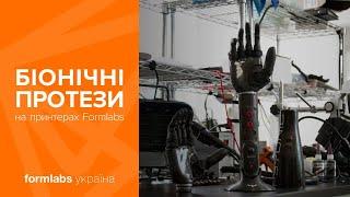 Біонічні протези надруковані на 3D-принтерах Formlabs