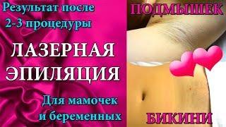 ЛАЗЕРНАЯ ЭПИЛЯЦИЯ БИКИНИ И ПОДМЫШЕК В СОЧИ ️ BEAUTY CLUB MAFIA SOCHI  ЛАЗЕР ДЛЯ МАМОЧЕК