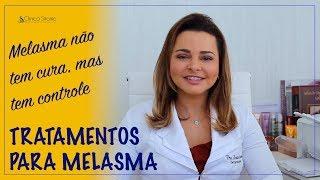 Tratamentos para melasma - Dra Renata Sitonio.