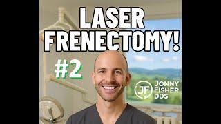 Laser Frenectomy! (Lower Lip)