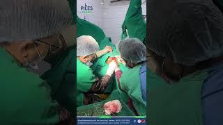 LASER  FISSURECTOMY WITH SKIN TAG |   EXCISION WITH ANAL DILATATION