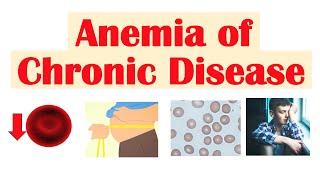 Anemia of Chronic Disease | Causes, Pathophysiology, Signs & Symptoms, Diagnosis, Treatment