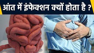 आंतों में Infection की असली वजह | आंत में इंफेक्शन क्यों होता है | Boldsky