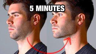 How to Get A More Defined Jawline - In Only 5 Minutes!