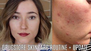 Accutane Round Two + Drugstore Skincare Routine