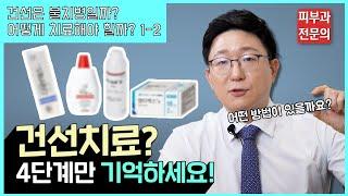 건선치료는 딱 4가지만 기억해주세요!ㅣ피부과전문의