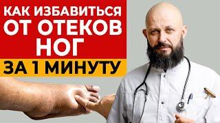 Убери отёки ног за 1 минуту! Быстрое лечение отеков ног