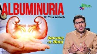 Albuminuria Treatment , Causes & Symptoms By Dr. Yasir Arafath - Amraaz o ilaaj - iPlus TV