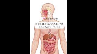 Причины заброса желчи в желудок. Часть 2