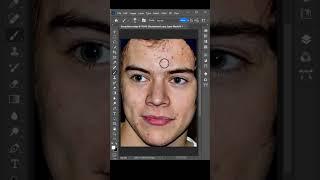How to remove skin blemishes easily using Photoshop