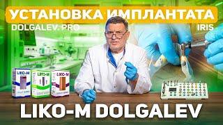 Этап имплантации. Мастер-класс по установке дентального имплантата Liko-M Dolgalev.