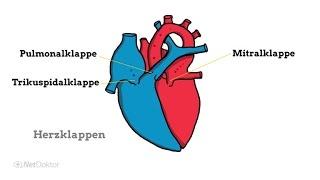 Herzklappenfehler: Die verschiedenen Formen - NetDoktor.de