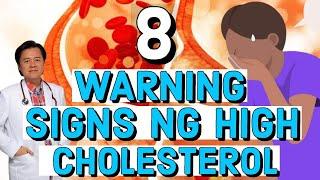 8 Warning Signs ng High Cholesterol - Tips by Doc Willie Ong (Internist and Cardiologist)