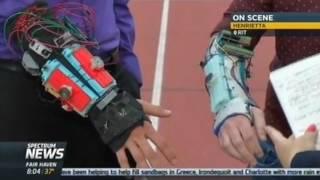 RIT on TV: Imagine RIT Preview - Tremor Mitigation Wearable Device