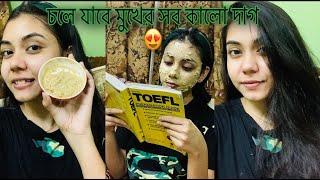 MY FAVORITE FACE PACK ||SPOT OUT FACEPACK || NOUREEN AFROSE PIYA