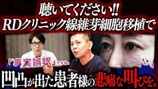 【再生美容医療終了】RDクリニックの再生医療による目の下凹凸の患者様をシンシアが修正。凹凸になった理由を立位3DCTで完全解説します。【北條先生】