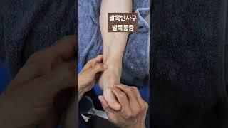발목반사구 발목통증