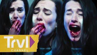 Parasitic Infection Leads To Patient Loosing Teeth | Urban Legend | Travel Channel