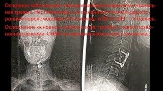Восстановление после перелома шеи.