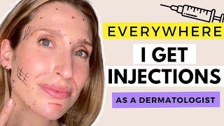 Exactly Where I Get Injections and Why | Best Botox and Filler Placement | Dr. Sam Ellis