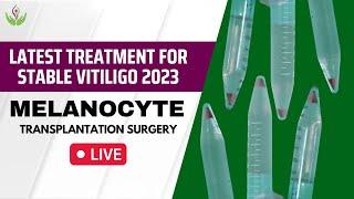 Advanced Treatment For Stable Vitiligo 2023 | Melanocyte Transplantation Surgery For White Patches