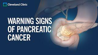 6 Warning Signs of Pancreatic Cancer