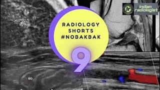 WHAT IS THE FINDING | WHAT SURGERY HAS BEEN PERFORMED IN THE PAST | NOBAKBAK RADIOLOGY SHORTS