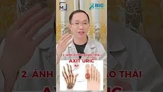 Vì sao bệnh xương khớp hạn chế ăn thịt đỏ | Bác Sĩ Trần Minh #short #shorts #bacsitranminh