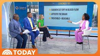 Doctor Shares Prevention Tips and Common Symptoms for Strokes