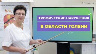 ТРОФИЧЕСКИЕ НАРУШЕНИЯ В ОБЛАСТИ ГОЛЕНИ [ШИШОВА О.И.]