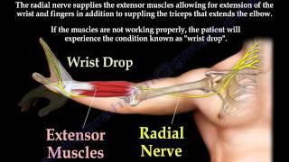 Radial Nerve Palsy, injury -  WRIST DROP . Everything You Need To Know - Dr. Nabil Ebraheim