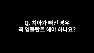 석플란트 - Q. 치아가 빠진 경우 꼭 임플란트만 해야 하나요? 다른 방법은 없나요?