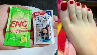 Eno से  मिनटों में साफ करें हाथ, पैर how to clean tan on hands or feet - Skin Whitening - fair skin