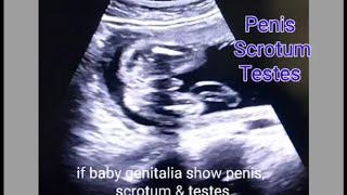 XX -Baby Girl | XY -Baby Boy | How to reveal gender on ultrasound | when genderreveal is poddible!