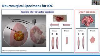 AANP Teaching Rounds - November 25, 2024 - Intraoperative Neuropathology