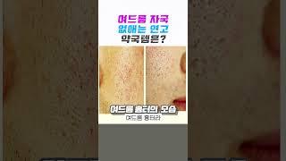 여드름 자국없애는 연고️약국템ㅣ여드름닥터 #여드름자국 #여드름흉터 #여드름흉터없애는방법