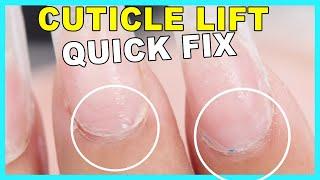 Fix Ugly Cuticles FAST⏱ - No Nail Fill Required