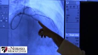 Coronary Stents - The Nebraska Medical Center