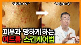 집에서 여드름 없애는 방법, 자가관리로 여드름 없애는법 (여드름 닥터가 알려드립니다)