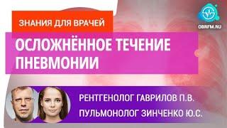 Рентгенолог Гаврилов П.В., пульмонолог Зинченко Ю.С.: Осложнённое течение пневмонии