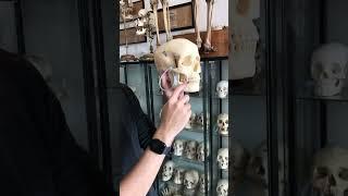 Unique Real human skull