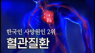 당신의 혈관은 깨끗하신가요? | 건강플러스 | 04월 08일