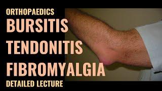 Bursitis, Tendonitis and Fibromyalgia - Detailed explanation - Emergency Medicine