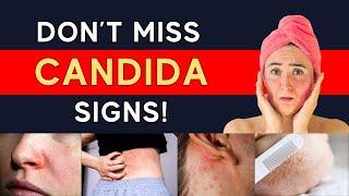 How To Identify Candida Overgrowth (Test Options + Symptoms Especially lf You Have Skin Rashes)