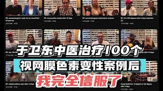 于卫东中医，治疗100个RP病例之后，我完全信服了 #中醫 #tcm #retinitispigmentosa