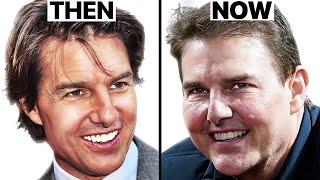Tom Cruise: Why His Face Looks Different | Plastic Surgery Analysis