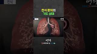 가슴이 답답하고 가래가 생기는 이유